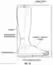 Fig. 03 - Dynamic socks and associated methods