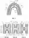 Fig. 02 - Mouthpiece for a Dental Cleaning Device, Method of Brushing Teeth, and Dental Cleaning Device Comprising the Mouthpiece