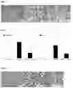 Fig. 02 - Pharmaceutical composition for preventing or treating nonalcoholic fatty liver disease, containing GPR119 ligand as active ingredient