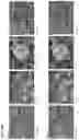 Fig. 50 - METHODS AND COMPOSITIONS FOR TREATING AND PREVENTING INFLAMMATORY DISEASES