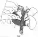 Fig. 06 - Device for forming Brunnian links