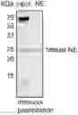 Fig. 01 - NOVEL ACTIVITY-BASED PROBES FOR NEUTROPHIL ELASTASE AND THEIR USE