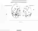 Fig. 06 - METHOD OF DETECTING CANCER AND/OR TUBERCULOSIS