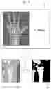 Fig. 07 - Apparatus, method and recording medium storing program for assessing bone age