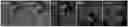 Fig. 01 - Systems for automated lesion detection and related methods