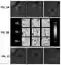 Fig. 04 - Systems for automated lesion detection and related methods