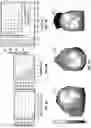 Fig. 07 - Systems for automated lesion detection and related methods