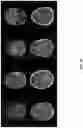 Fig. 11 - Systems for automated lesion detection and related methods
