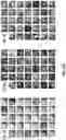 Fig. 18 - Systems for automated lesion detection and related methods