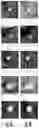 Fig. 22 - Systems for automated lesion detection and related methods