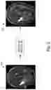 Fig. 09 - Systems and methods for generating normative imaging data for medical image processing using deep learning