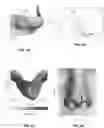 Fig. 06 - Systems and methods for assessment of nasal deviation and asymmetry