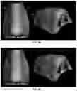 Fig. 08 - Systems and methods for assessment of nasal deviation and asymmetry