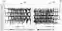 Fig. 01 - Advanced electronic device structures using semiconductor structures and superlattices