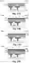 Fig. 10 - RRAM device with improved performance