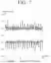 Fig. 08 - Abnormality determination for printer engine using vibration information thereof