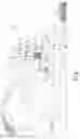 Fig. 02 - Forage harvester material applicator system and related method