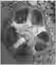 Fig. 01 - Solanaceous plant capable of stenospermocarpic fruit formation