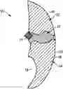 Fig. 01 - Conveying unit designed and configured for automatically conveying fillet-like meat products, in particular fish fillets, and method relating to same