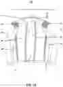 Fig. 02 - PROTECTIVE GARMENT