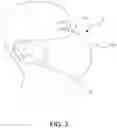 Fig. 04 - SMART MASK