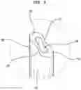 Fig. 08 - Interlocking zipper pull tabs and fastening system