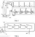 Fig. 02 - SYSTEM AND METHOD FOR DETECTING FLUID ACCUMULATION