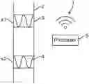 Fig. 01 - Pulse Wave Velocity Measurement