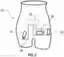 Fig. 03 - LOOP-BASED MEASURING DEVICE