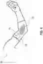 Fig. 05 - LOOP-BASED MEASURING DEVICE