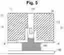 Fig. 05 - Wearable Sensor and Sweating Analysis Device