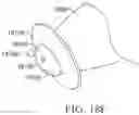 Fig. 33 - ANALYTE SENSOR