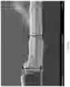 Fig. 20 - METAL PILLAR DEVICE STRUCTURES AND METHODS FOR MAKING AND USING THEM IN ELECTROCHEMICAL AND/OR ELECTROCATALYTIC APPLICATIONS