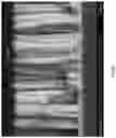 Fig. 79 - METAL PILLAR DEVICE STRUCTURES AND METHODS FOR MAKING AND USING THEM IN ELECTROCHEMICAL AND/OR ELECTROCATALYTIC APPLICATIONS