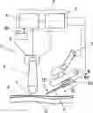 Fig. 01 - CANNULA INSERTION SYSTEM