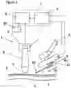 Fig. 02 - CANNULA INSERTION SYSTEM
