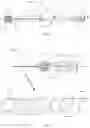 Fig. 04 - Systems and Methods for Phlebotomy Through a Peripheral IV Catheter