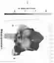 Fig. 30 - Computer implemented method and system for aiding mapping heart rhythm abnormalities