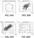Fig. 23 - Systems and methods for tremor detection and quantification