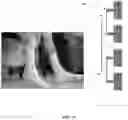 Fig. 16 - Antenna array or a group of antenna elements for biomarker monitoring, nerve stimulations and methods of use