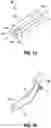 Fig. 02 - Orientable implantable device and method