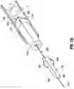 Fig. 04 - Orientable implantable device and method