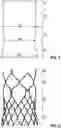 Fig. 02 - Prosthetic heart valve comprising a stent structure having a conical-convex inflow region and a linear cylindrical outflow region