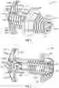 Fig. 02 - Interspinous process implant
