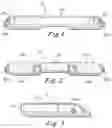 Fig. 02 - Oral appliance