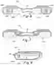 Fig. 04 - Oral appliance
