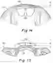 Fig. 07 - Oral appliance