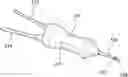 Fig. 01 - NEW AND IMPROVED VITRECTOR AND METHOD FOR PERFORMING A ONE-STEP POSTERIOR VITRECTOMY USING THE SAME