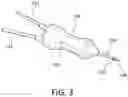 Fig. 04 - NEW AND IMPROVED VITRECTOR AND METHOD FOR PERFORMING A ONE-STEP POSTERIOR VITRECTOMY USING THE SAME
