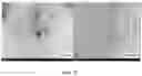Fig. 19 - Polymerized whey protein encapsulated antioxidant compound and a process for preparation of same